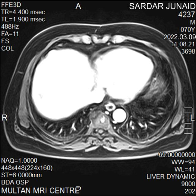 Dataset Image