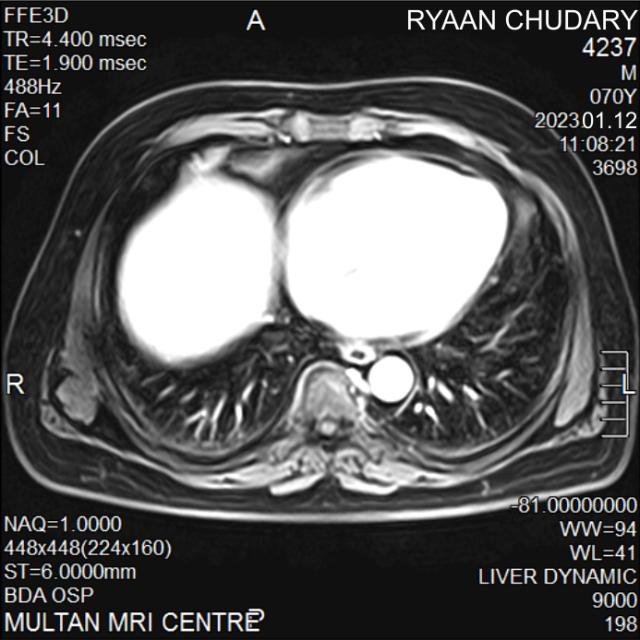 Dataset Image