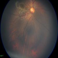 Dataset Image