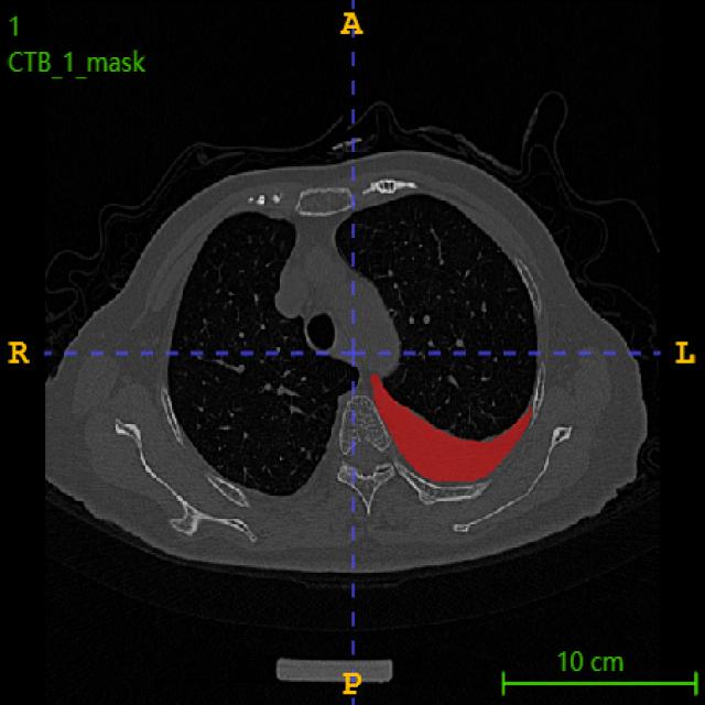 Dataset Image