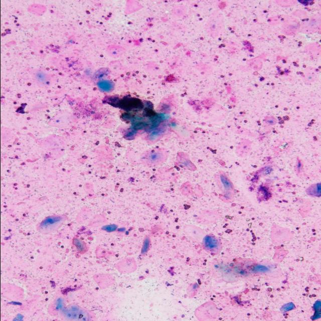 Dataset Image