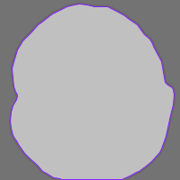 Potato Leaves Disease Detection Object Detection Dataset (v3, 2024-03 ...