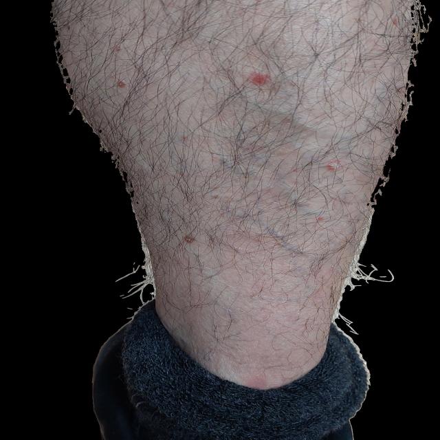 Dataset Image