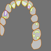 Annotation Visualization