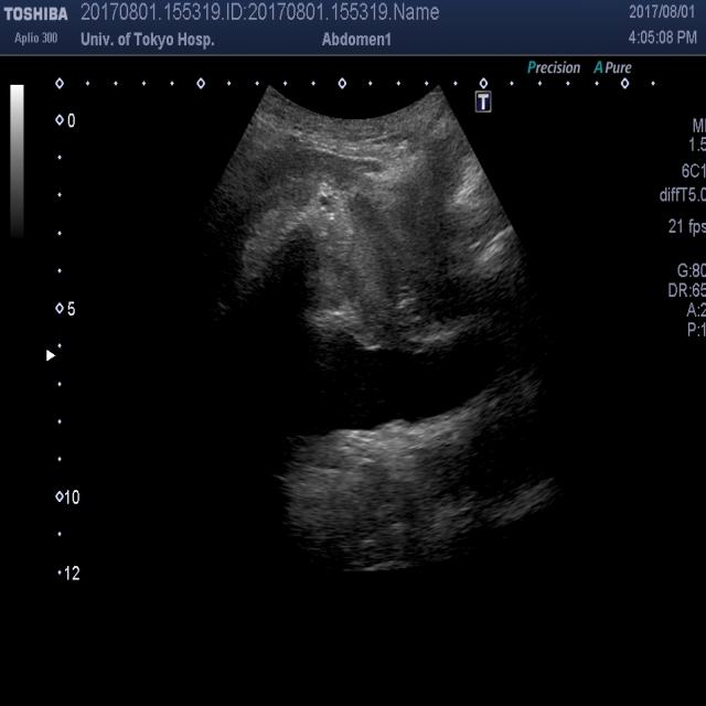 Dataset Image