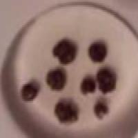 Bristol Stool Classification Model (v1, 2025-10-13 12:21pm) by Project