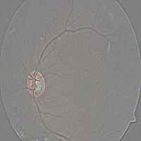 Dataset Image