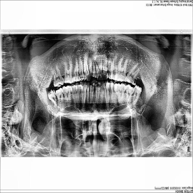 Dataset Image