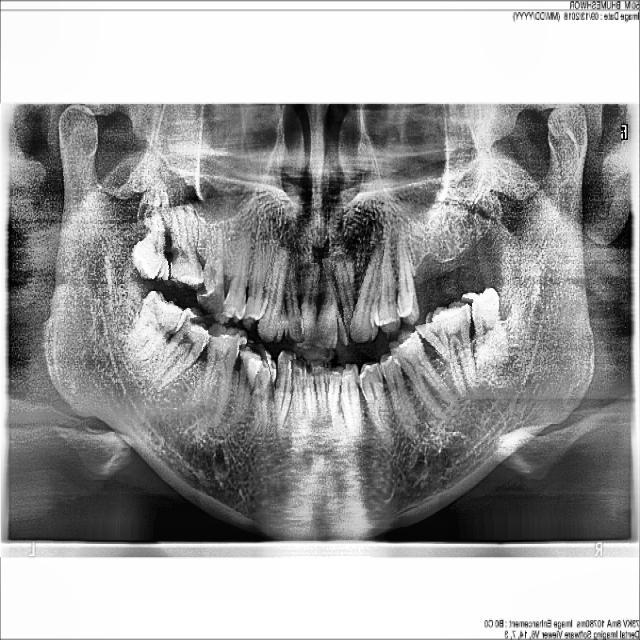 Dataset Image