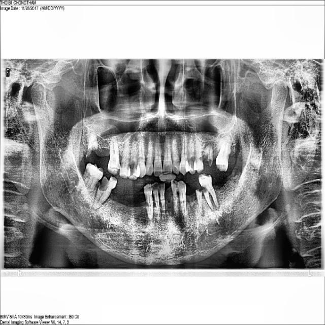 Dataset Image