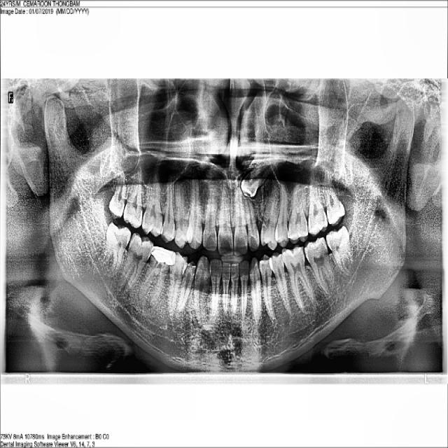 Dataset Image