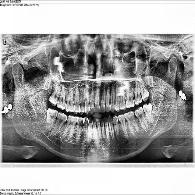 Dataset Image