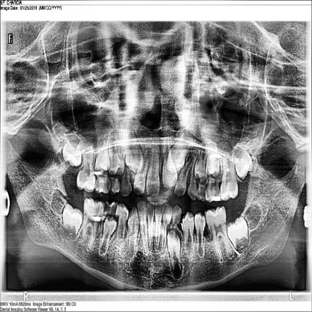 Dataset Image