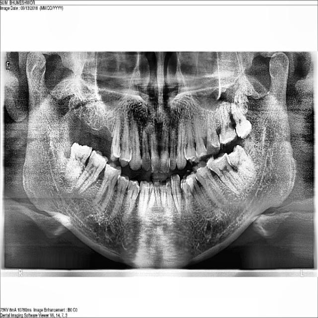 Dataset Image
