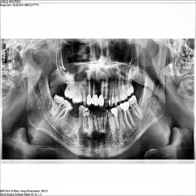 Dataset Image