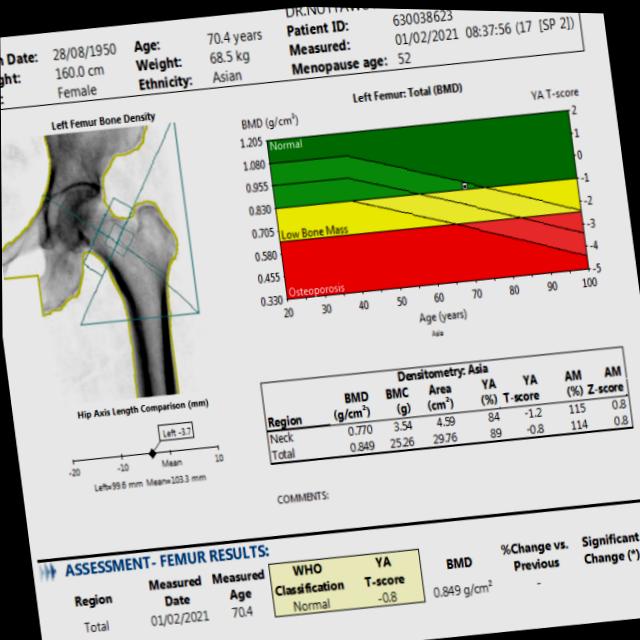 Dataset Image