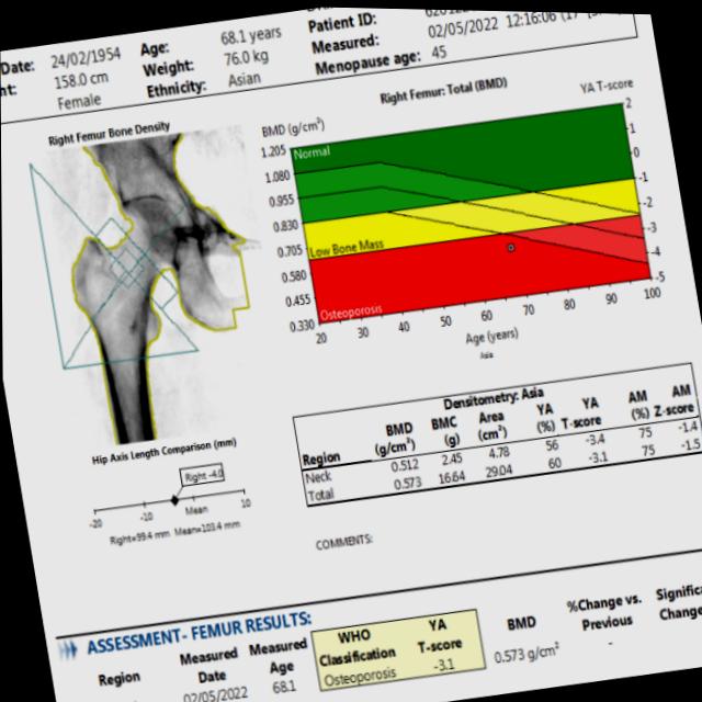 Dataset Image