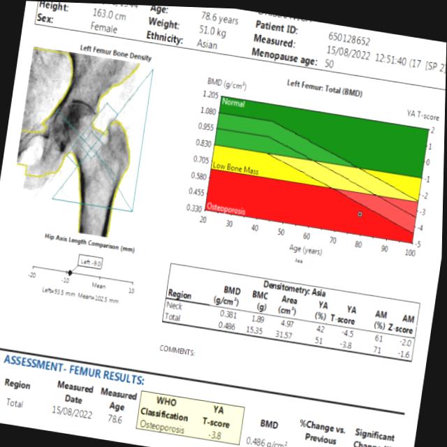 Dataset Image