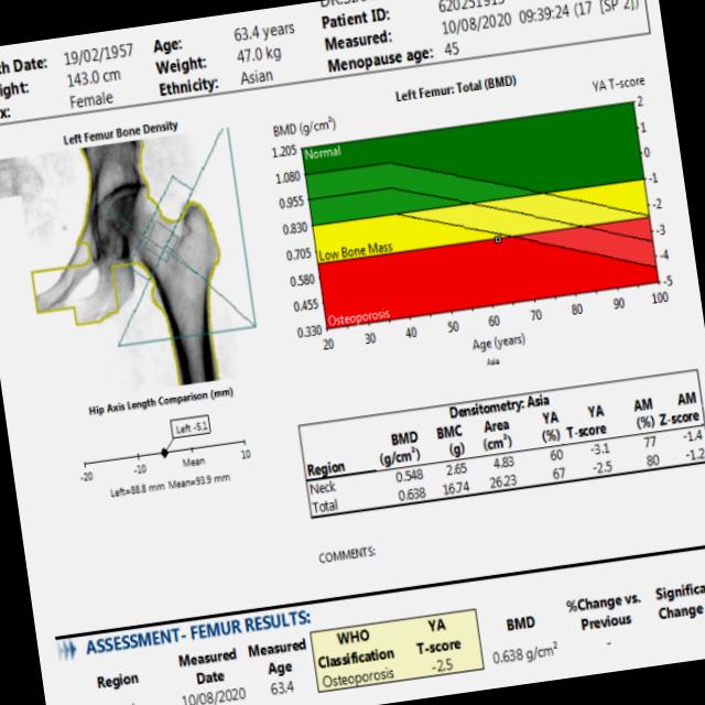 Dataset Image