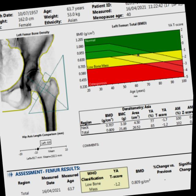 Dataset Image