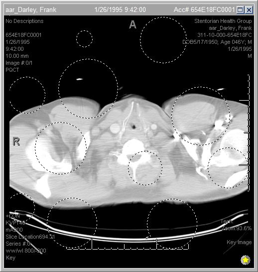 Dataset Image