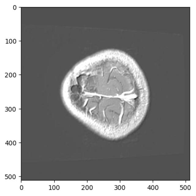 Dataset Image