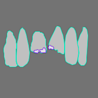 Annotation Visualization