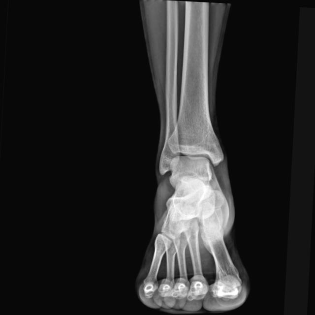 Dataset Image