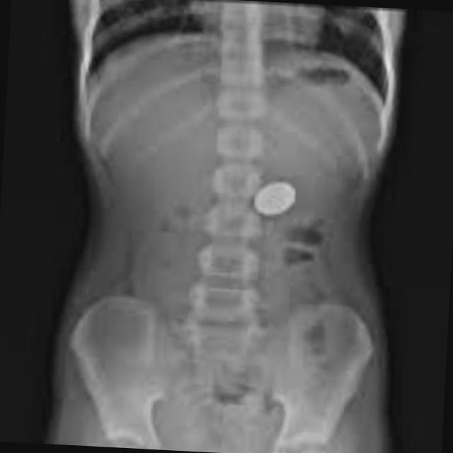 Dataset Image