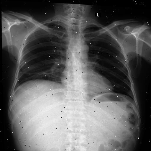Dataset Image