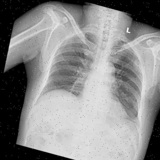 Dataset Image