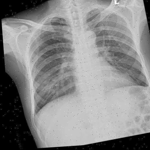 Dataset Image