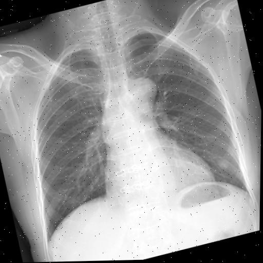 Dataset Image