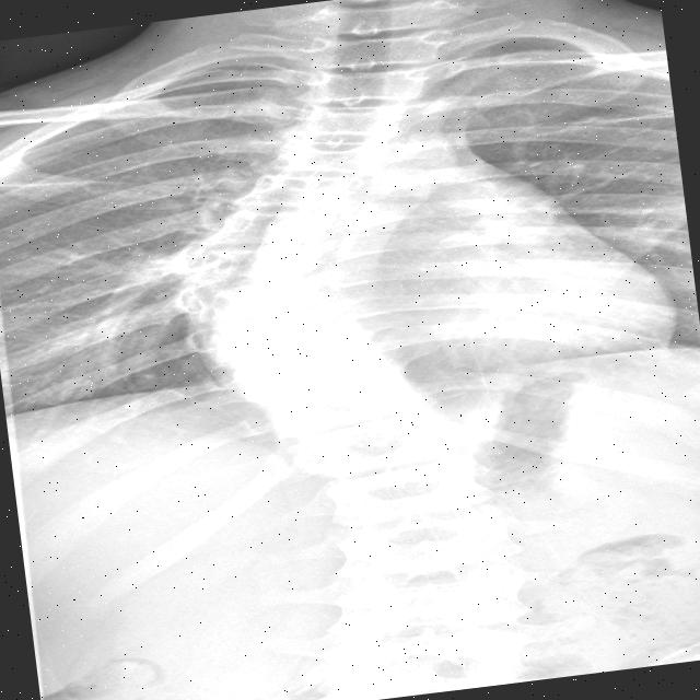 Dataset Image