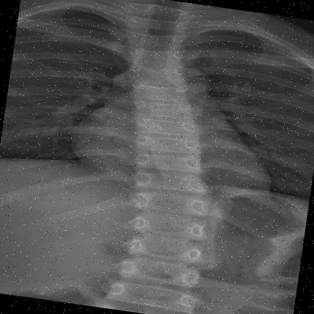 Dataset Image