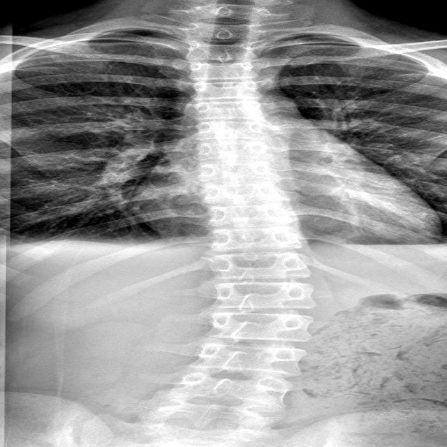 Dataset Image