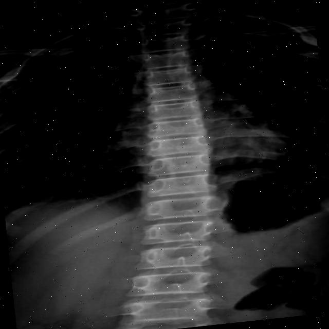 Dataset Image