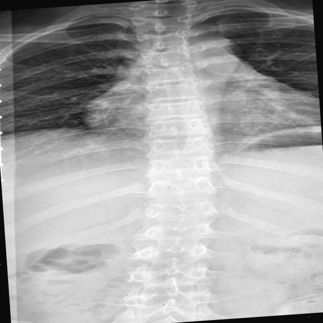 Dataset Image