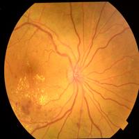 Dataset Image