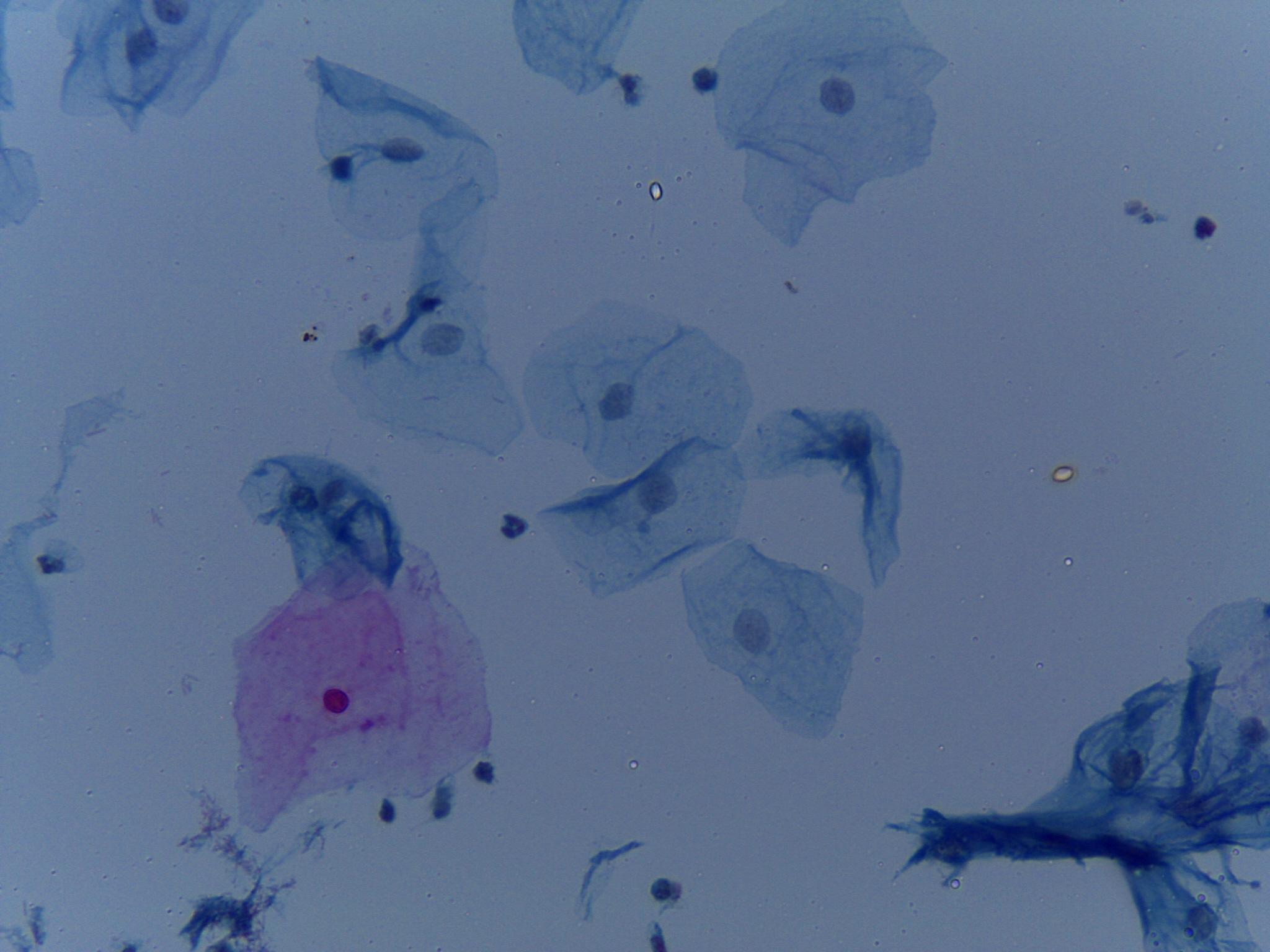 Dataset Image