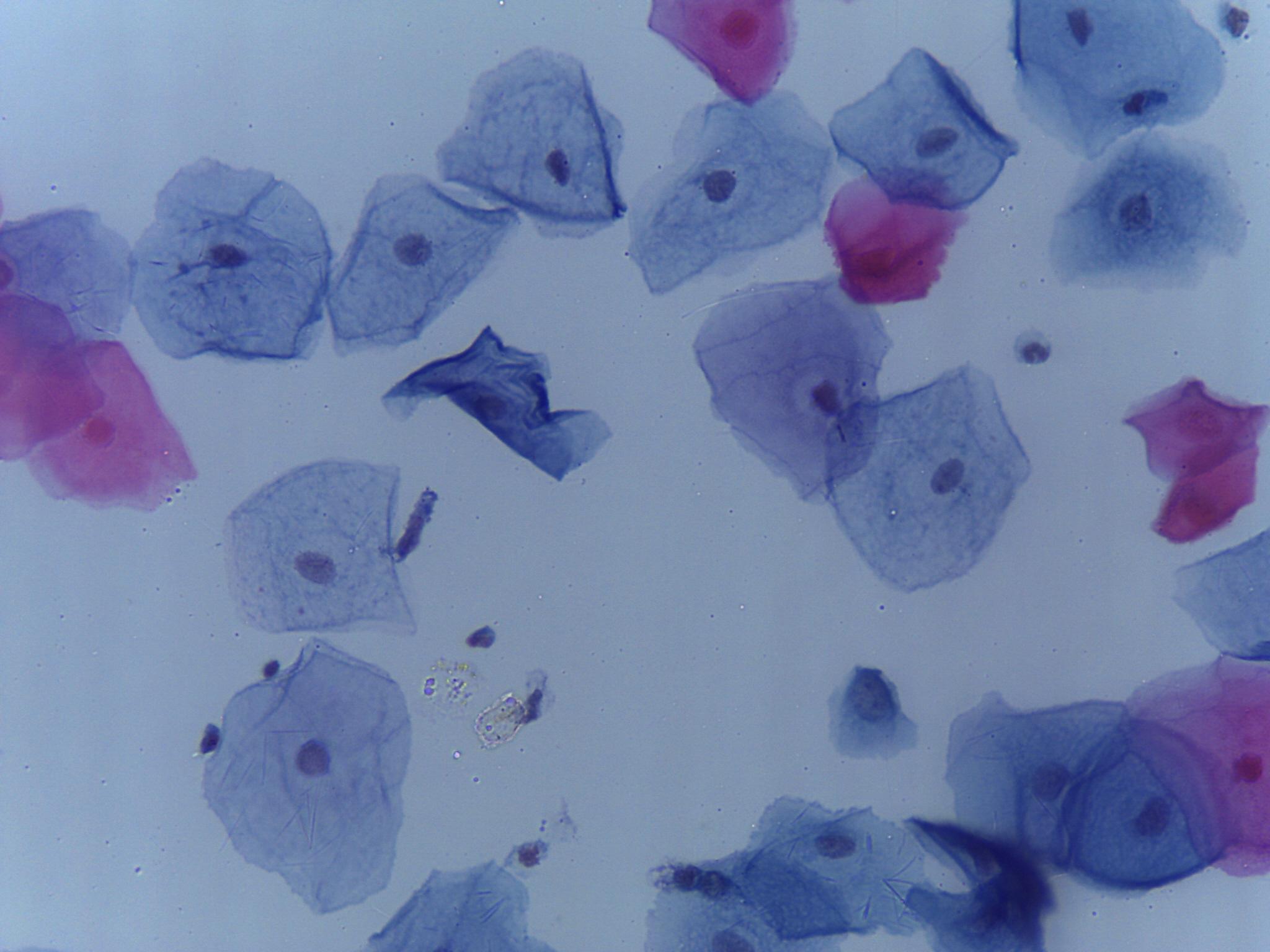 Dataset Image