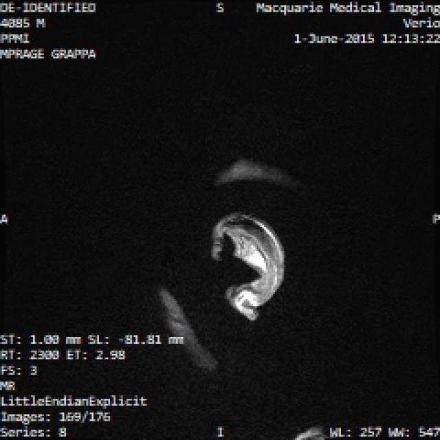 Dataset Image